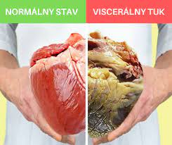Viscerálny tuk: Skrytá hrozba pre naše zdravie